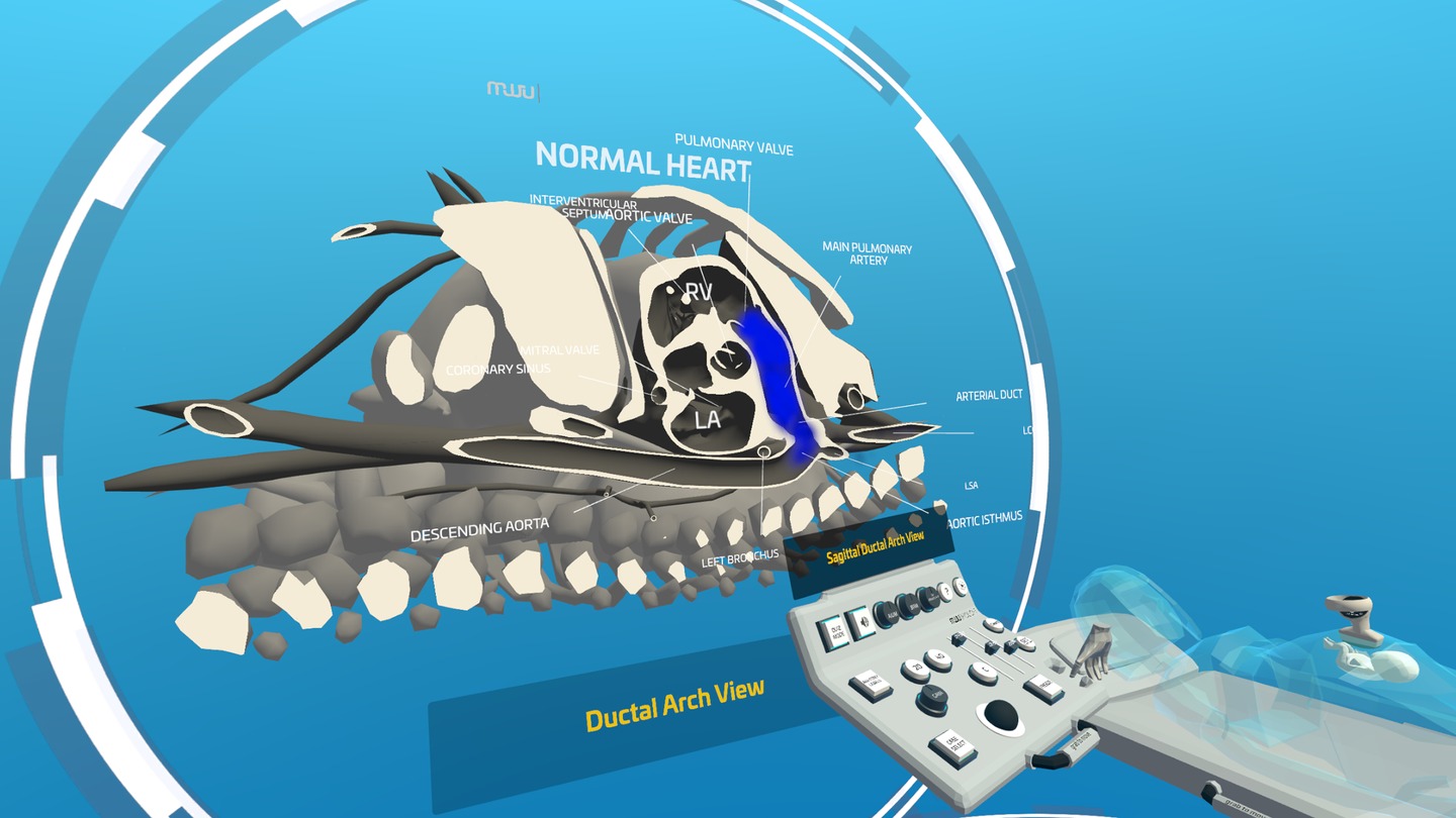 Fetal Heart VR Screenshot 1
